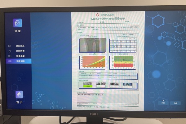 骨密度低怎么辦？養(yǎng)成良好生活習(xí)慣，從多方面增強(qiáng)骨密度